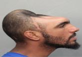 Half-head Mugshot / Carlos Rodriguez