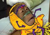 Dying Orangutan