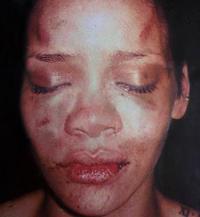 Chris Brown Shaming